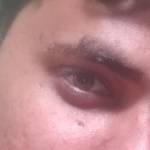 harish