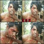 Local suresh
